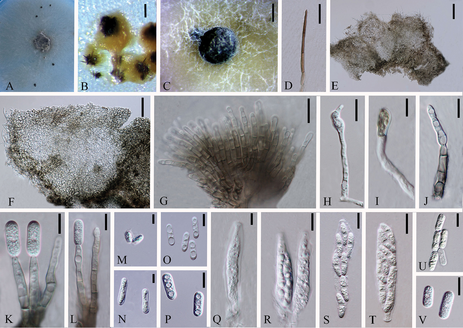 Endophytic Colletotrichum Species From Dendrobium Spp In China And Northern Thailand