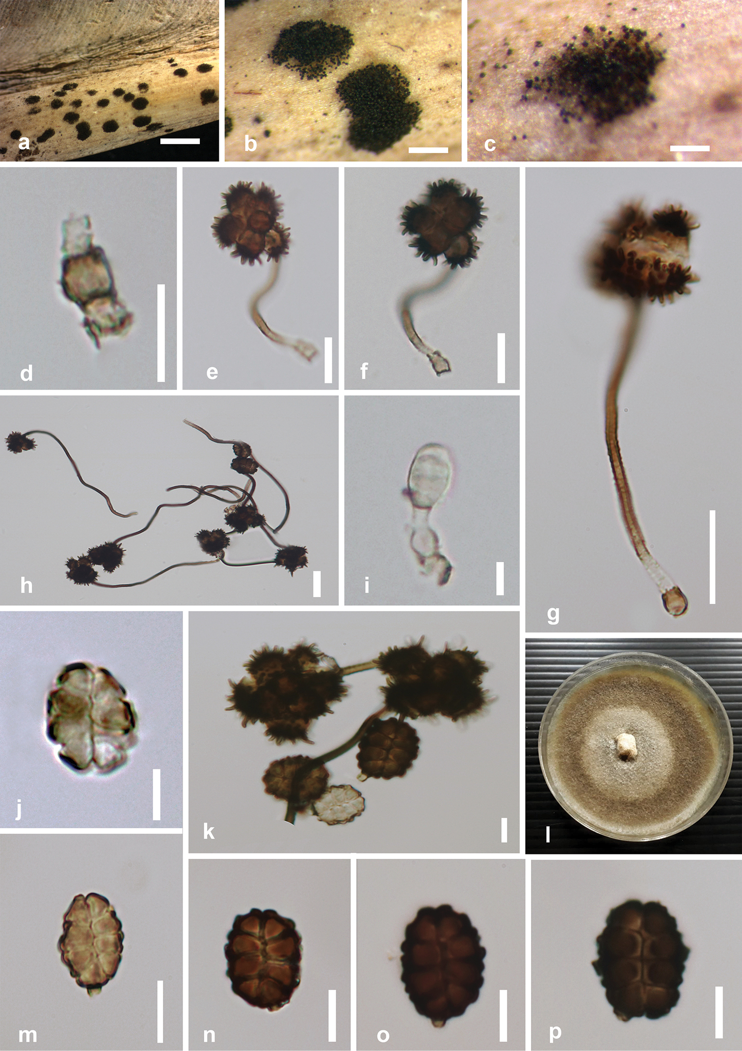 Taxonomy And Phylogenetic Appraisal Of Spegazzinia Musae Sp Nov And S Deightonii Didymosphaeriaceae Pleosporales On Musaceae From Thailand
