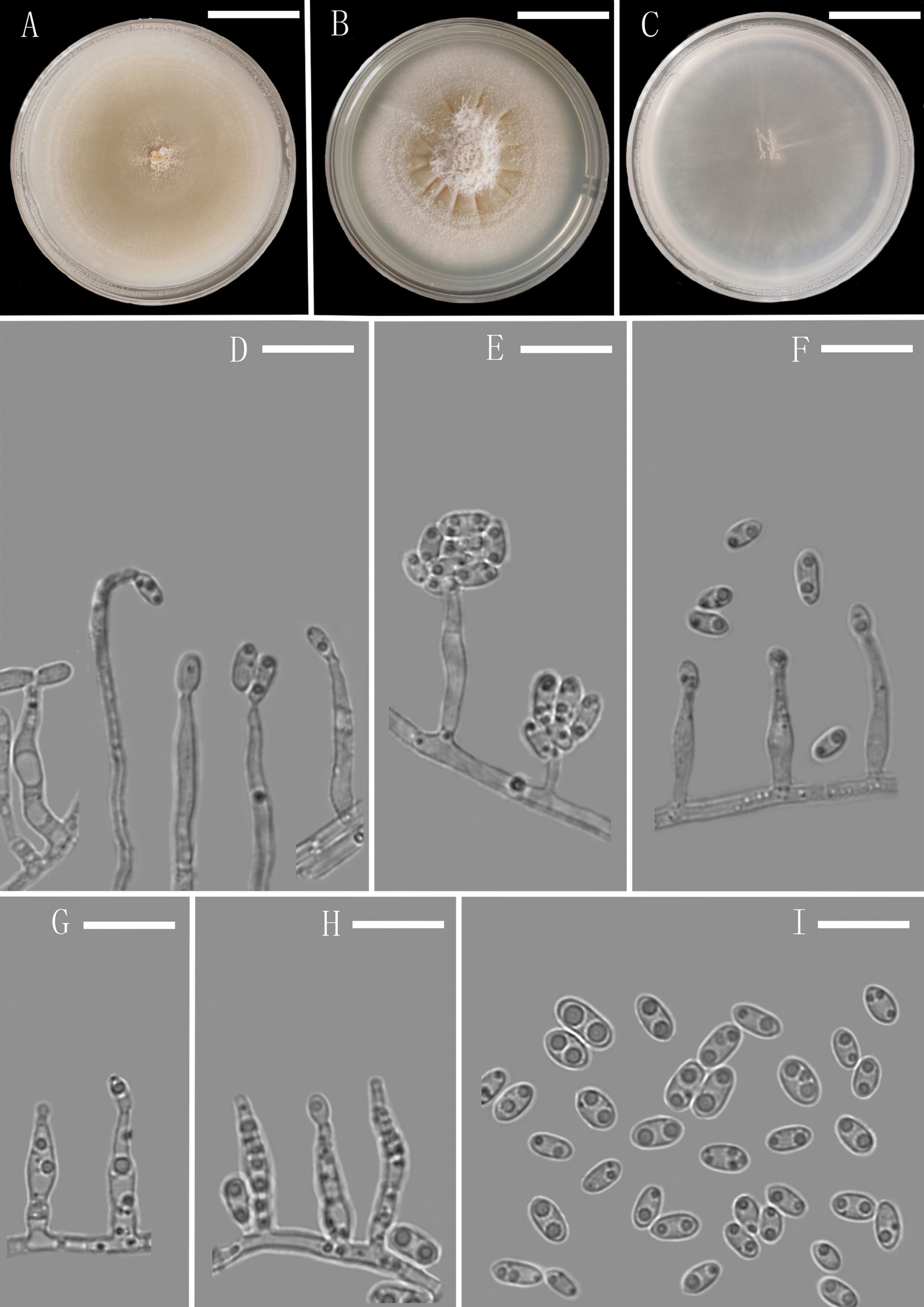 Diversity of Plectosphaerella within aquatic plants from southwest ...